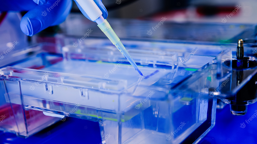 Unlocking the Secrets of Polyacrylamide: Exploring the Difference Between SDS and Gel Electrophoresis Principles!